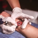 Tattooing